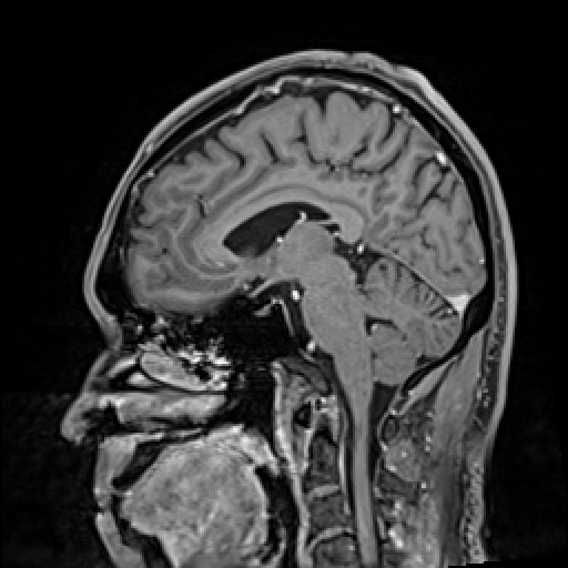 Click on the Serie image to view the images of VILLANUEVA, WILLIAM A.